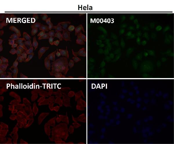 WB - Anti-NOX4 Rabbit Monoclonal Antibody ABO13341